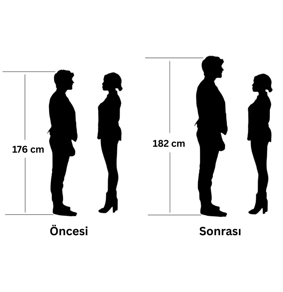 Milofy LiftStep™ Gizli Boy Uzatıcı Silikon