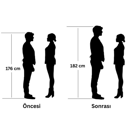 Milofy LiftStep™ Gizli Boy Uzatıcı Silikon